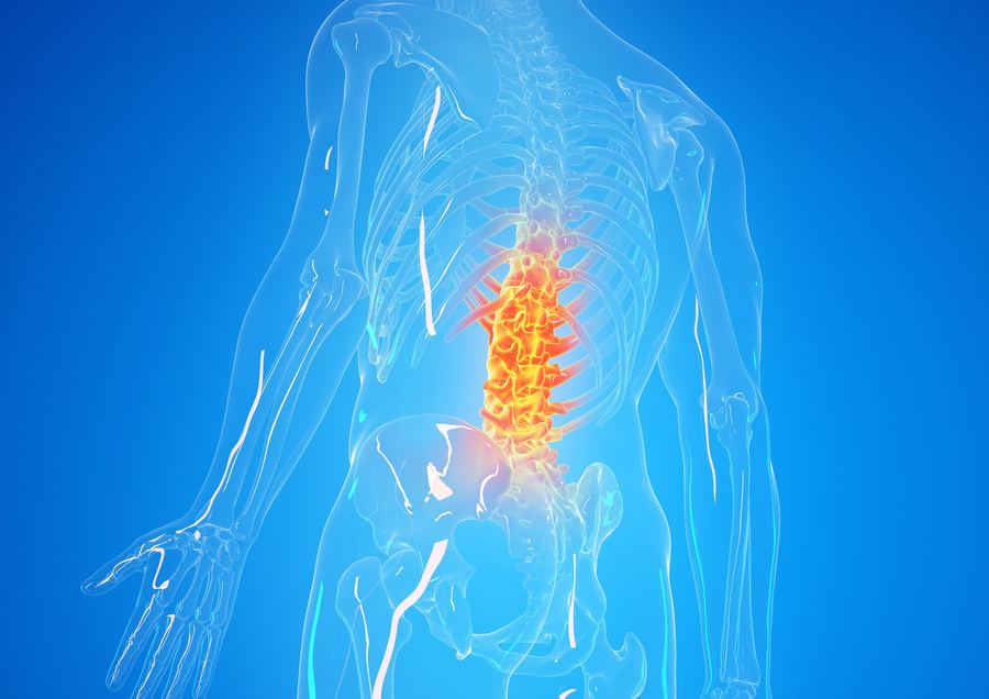 Illustration of the lower spine with the painful area highlighted