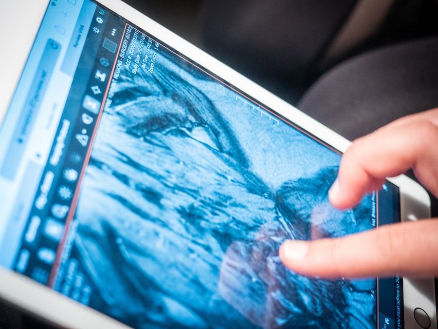 A spinal scan reviewed on a tablet